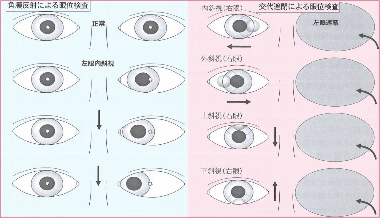 乳児健診 10ヶ月 こどもの疾患 太田東こども おとな診療所 こどもとおとなの病気について 気軽に相談できる診療所です