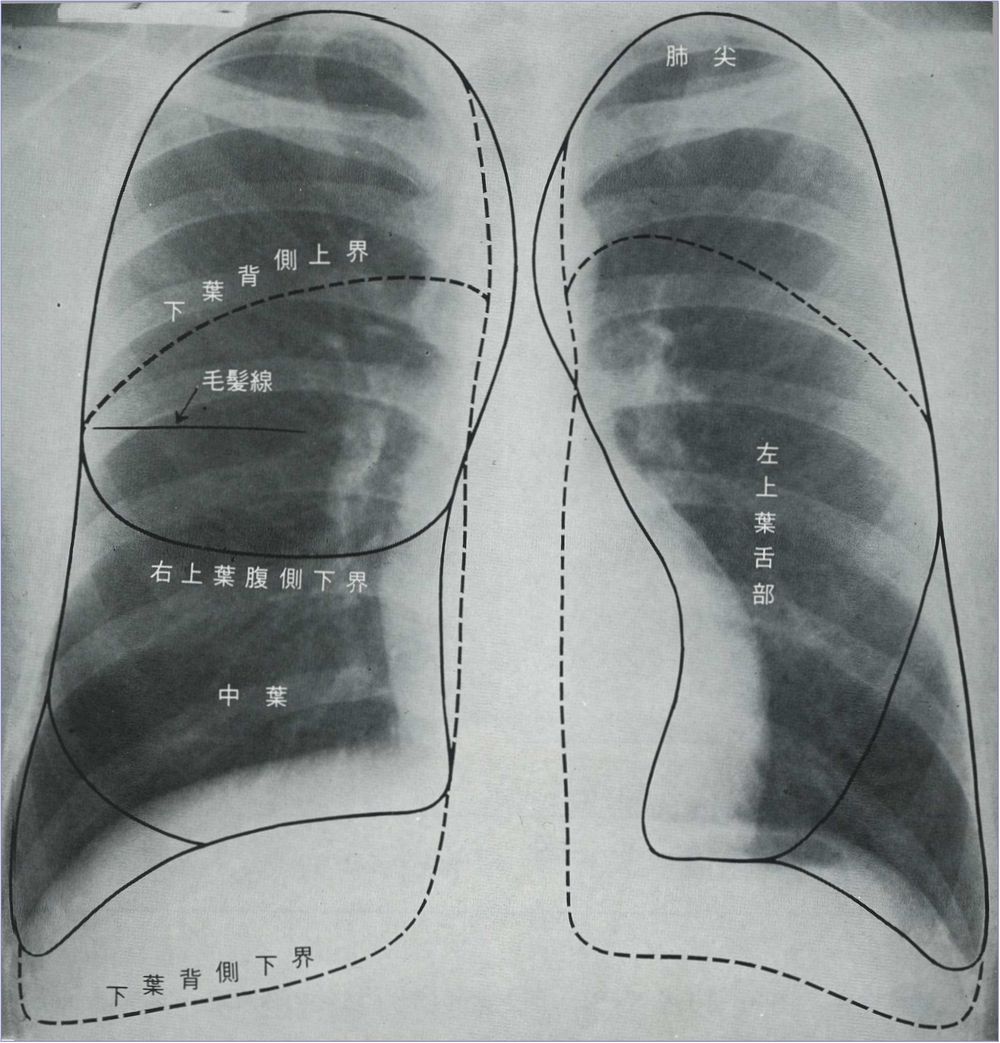 胸部の構造 胸部写真の読み方 太田東こども おとな診療所 こどもとおとなの病気について 気軽に相談できる診療所です