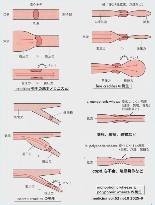 呼吸音発生機序