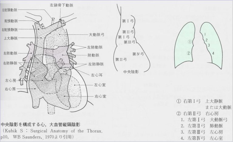 X線診断の基礎知識｜胸部写真の読み方｜太田東こども＆おとな診療所｜こどもとおとなの病気について、気軽に相談できる診療所です。