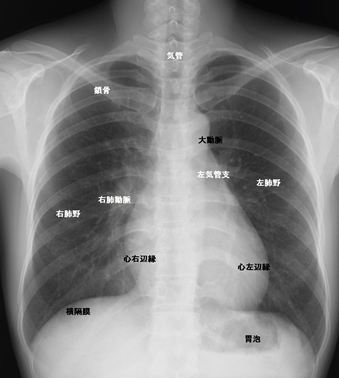胸部の構造 胸部写真の読み方 太田東こども おとな診療所 こどもとおとなの病気について 気軽に相談できる診療所です